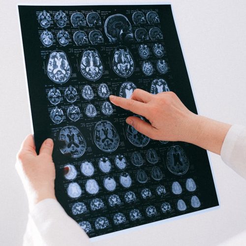 A medical professional examines a brain MRI scan, focusing on neurological health.